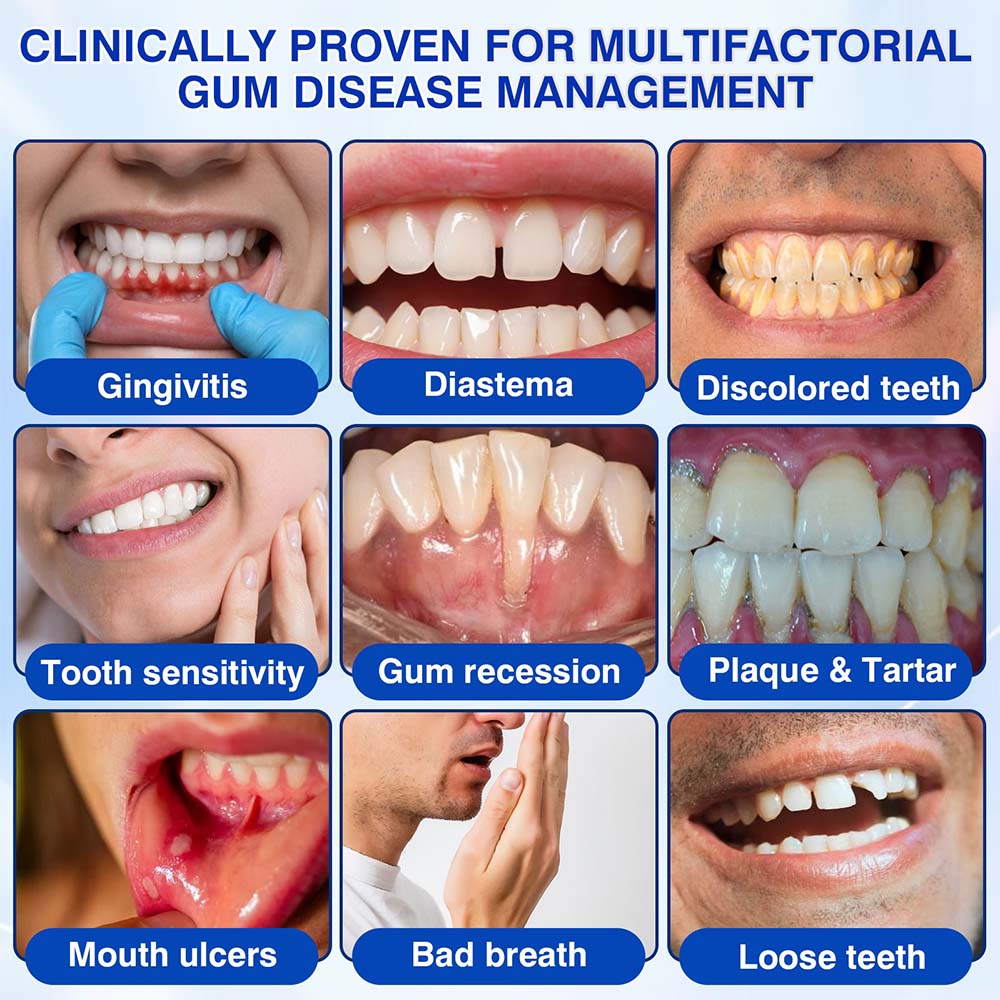 🦷🦢Healrize® GumRevive gel for the regeneration of the tooth-supporting apparatus (for bleeding gums, receding gums, and loose teeth)🐰
