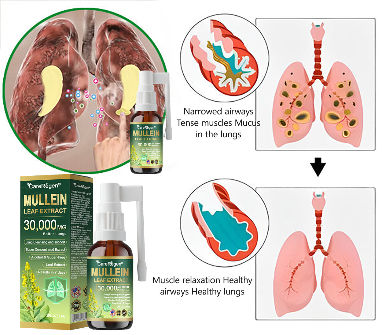 𝗢𝗳𝗳𝗶𝗰𝗶𝗮𝗹 | CareRegen® Organic Lung Cleansing Mullein Leaf Extract Spray 🌈 𝐂𝐥𝐢𝐧𝐢𝐜𝐚𝐥𝐥𝐲 𝐩𝐫𝐨𝐯𝐞𝐧, 𝐡𝐢𝐠𝐡𝐥𝐲 𝐜𝐨𝐧𝐜𝐞𝐧𝐭𝐫𝐚𝐭𝐞𝐝 𝐟𝐨𝐫𝐦𝐮𝐥𝐚 𝐭𝐡𝐚𝐭 𝐫𝐞𝐥𝐢𝐞𝐯𝐞𝐬 𝐜𝐨𝐮𝐠𝐡, 𝐩𝐡𝐥𝐞𝐠𝐦, 𝐚𝐬𝐭𝐡𝐦𝐚 & 𝐂𝐎𝐏𝐃 — 𝐛𝐫𝐞𝐚𝐭𝐡𝐞 𝐞𝐚𝐬𝐢𝐞𝐫, 𝐟𝐚𝐬𝐭𝐞𝐫.🌈🌼