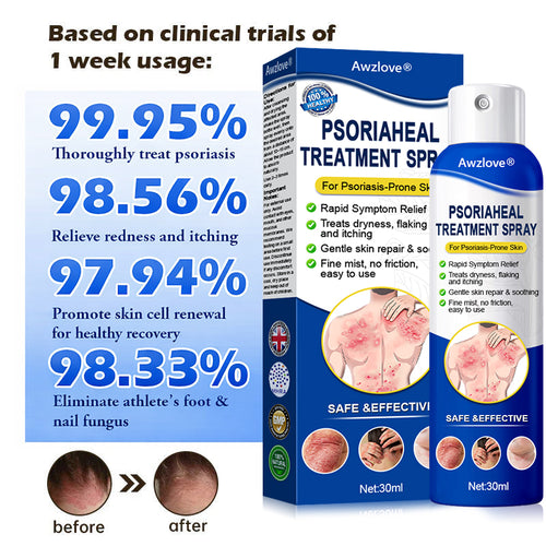 Awzlove® PsoriaHeal  Treatment Spray(Suitable for all skin conditions)