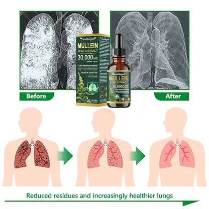 𝗢𝗳𝗳𝗶𝗰𝗶𝗮𝗹 𝗦𝘁𝗼𝗿𝗲:CareRegen® 𝗢𝗿𝗴𝗮𝗻𝗶𝗰 𝗟𝘂𝗻𝗴 𝗖𝗹𝗲𝗮𝗻𝘀𝗶𝗻𝗴 𝗠𝘂𝗹𝗹𝗲𝗶𝗻 𝗟𝗲𝗮𝗳 𝗘𝘅𝘁𝗿𝗮𝗰𝘁 𝗗𝗿𝗼𝗽𝘀 𝐂𝐥𝐢𝐧𝐢𝐜𝐚𝐥𝐥𝐲 𝐩𝐫𝐨𝐯𝐞𝐧, 𝐡𝐢𝐠𝐡𝐥𝐲 𝐜𝐨𝐧𝐜𝐞𝐧𝐭𝐫𝐚𝐭𝐞𝐝 𝐟𝐨𝐫𝐦𝐮𝐥𝐚 𝐭𝐡𝐚𝐭 𝐫𝐞𝐥𝐢𝐞𝐯𝐞𝐬 𝐜𝐨𝐮𝐠𝐡, 𝐩𝐡𝐥𝐞𝐠𝐦, 𝐚𝐬𝐭𝐡𝐦𝐚 & 𝐂𝐎𝐏𝐃 — 𝐛𝐫𝐞𝐚𝐭𝐡𝐞 𝐞𝐚𝐬𝐢𝐞𝐫, 𝐟𝐚𝐬𝐭𝐞𝐫.🎁