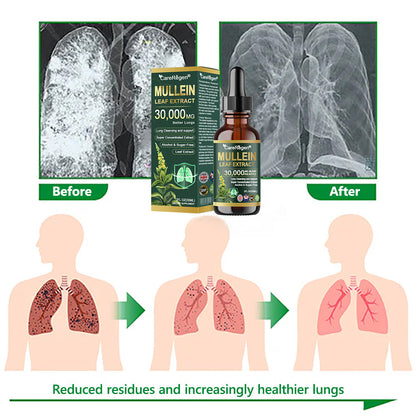 𝗢𝗳𝗳𝗶𝗰𝗶𝗮𝗹 𝗦𝘁𝗼𝗿𝗲:CareRegen® 𝗢𝗿𝗴𝗮𝗻𝗶𝗰 𝗟𝘂𝗻𝗴 𝗖𝗹𝗲𝗮𝗻𝘀𝗶𝗻𝗴 𝗠𝘂𝗹𝗹𝗲𝗶𝗻 𝗟𝗲𝗮𝗳 𝗘𝘅𝘁𝗿𝗮𝗰𝘁 𝗗𝗿𝗼𝗽𝘀  𝐂𝐥𝐢𝐧𝐢𝐜𝐚𝐥𝐥𝐲 𝐩𝐫𝐨𝐯𝐞𝐧, 𝐡𝐢𝐠𝐡𝐥𝐲 𝐜𝐨𝐧𝐜𝐞𝐧𝐭𝐫𝐚𝐭𝐞𝐝 𝐟𝐨𝐫𝐦𝐮𝐥𝐚 𝐭𝐡𝐚𝐭 𝐫𝐞𝐥𝐢𝐞𝐯𝐞𝐬 𝐜𝐨𝐮𝐠𝐡, 𝐩𝐡𝐥𝐞𝐠𝐦, 𝐚𝐬𝐭𝐡𝐦𝐚 & 𝐂𝐎𝐏𝐃 — 𝐛𝐫𝐞𝐚𝐭𝐡𝐞 𝐞𝐚𝐬𝐢𝐞𝐫, 𝐟𝐚𝐬𝐭𝐞𝐫. 🌬️🍃