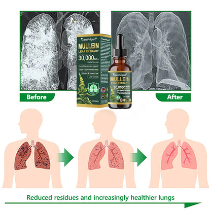 𝗢𝗳𝗳𝗶𝗰𝗶𝗮𝗹 𝗦𝘁𝗼𝗿𝗲:CareRegen®🫁💧 𝗢𝗿𝗴𝗮𝗻𝗶𝗰 𝗟𝘂𝗻𝗴 𝗖𝗹𝗲𝗮𝗻𝘀𝗶𝗻𝗴 𝗠𝘂𝗹𝗹𝗲𝗶𝗻 𝗟𝗲𝗮𝗳 𝗘𝘅𝘁𝗿𝗮𝗰𝘁 𝗗𝗿𝗼𝗽𝘀  𝐂𝐥𝐢𝐧𝐢𝐜𝐚𝐥𝐥𝐲 𝐩𝐫𝐨𝐯𝐞𝐧, 𝐡𝐢𝐠𝐡𝐥𝐲 𝐜𝐨𝐧𝐜𝐞𝐧𝐭𝐫𝐚𝐭𝐞𝐝 𝐟𝐨𝐫𝐦𝐮𝐥𝐚 𝐭𝐡𝐚𝐭 𝐫𝐞𝐥𝐢𝐞𝐯𝐞𝐬 𝐜𝐨𝐮𝐠𝐡, 𝐩𝐡𝐥𝐞𝐠𝐦, 𝐚𝐬𝐭𝐡𝐦𝐚 & 𝐂𝐎𝐏𝐃 — 𝐛𝐫𝐞𝐚𝐭𝐡𝐞 𝐞𝐚𝐬𝐢𝐞𝐫, 𝐟𝐚𝐬𝐭𝐞𝐫. 🌥️🪶