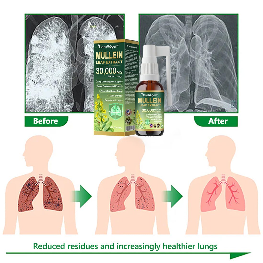 𝗢𝗳𝗳𝗶𝗰𝗶𝗮𝗹 | CareRegen® Organic Lung Cleansing Mullein Leaf Extract Spray 🌈 𝐂𝐥𝐢𝐧𝐢𝐜𝐚𝐥𝐥𝐲 𝐩𝐫𝐨𝐯𝐞𝐧, 𝐡𝐢𝐠𝐡𝐥𝐲 𝐜𝐨𝐧𝐜𝐞𝐧𝐭𝐫𝐚𝐭𝐞𝐝 𝐟𝐨𝐫𝐦𝐮𝐥𝐚 𝐭𝐡𝐚𝐭 𝐫𝐞𝐥𝐢𝐞𝐯𝐞𝐬 𝐜𝐨𝐮𝐠𝐡, 𝐩𝐡𝐥𝐞𝐠𝐦, 𝐚𝐬𝐭𝐡𝐦𝐚 & 𝐂𝐎𝐏𝐃 — 𝐛𝐫𝐞𝐚𝐭𝐡𝐞 𝐞𝐚𝐬𝐢𝐞𝐫, 𝐟𝐚𝐬𝐭𝐞𝐫.🌈🌼