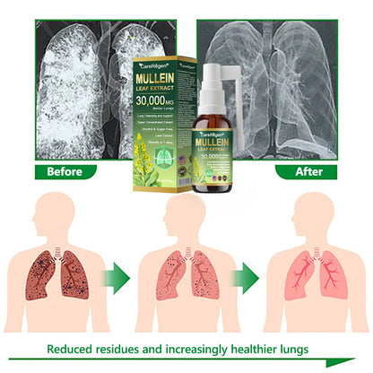 𝗢𝗳𝗳𝗶𝗰𝗶𝗮𝗹 | CareRegen® Organic Lung Cleansing Mullein Leaf Extract Spray 🌈 𝐂𝐥𝐢𝐧𝐢𝐜𝐚𝐥𝐥𝐲 𝐩𝐫𝐨𝐯𝐞𝐧, 𝐡𝐢𝐠𝐡𝐥𝐲 𝐜𝐨𝐧𝐜𝐞𝐧𝐭𝐫𝐚𝐭𝐞𝐝 𝐟𝐨𝐫𝐦𝐮𝐥𝐚 𝐭𝐡𝐚𝐭 𝐫𝐞𝐥𝐢𝐞𝐯𝐞𝐬 𝐜𝐨𝐮𝐠𝐡, 𝐩𝐡𝐥𝐞𝐠𝐦, 𝐚𝐬𝐭𝐡𝐦𝐚 & 𝐂𝐎𝐏𝐃 — 𝐛𝐫𝐞𝐚𝐭𝐡𝐞 𝐞𝐚𝐬𝐢𝐞𝐫, 𝐟𝐚𝐬𝐭𝐞𝐫.🌈🌼