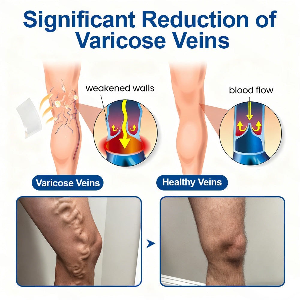 🇬🇧 Healrize® VeinTarget Microneedle Patch Instant Relief, Long-Term Results🦵💯