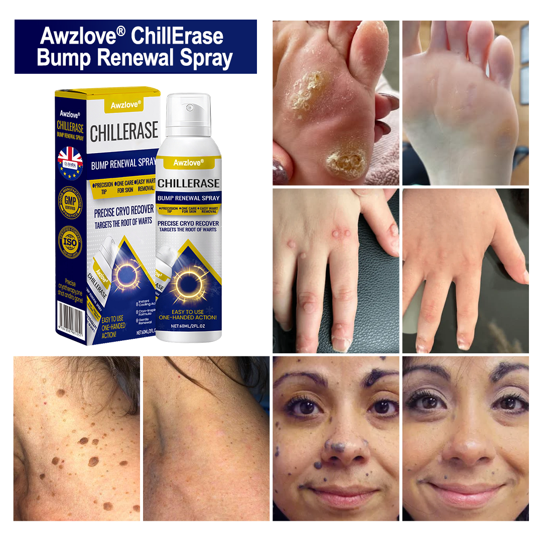 Awzlove® 🐱‍💻ChillErase Bump Renewal Spray-Rediscover Smooth, Clear, and Confident Skin💧